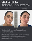 Ácido Glicólico al 8% con Centella Asiática (200ml) | Ético Skin Lab