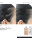 Shampoo Ginseng + Niacinamida (500ml)